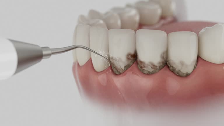 Reliable Dental Implants contractor in Crooks, SD by Smile Center Dentistry